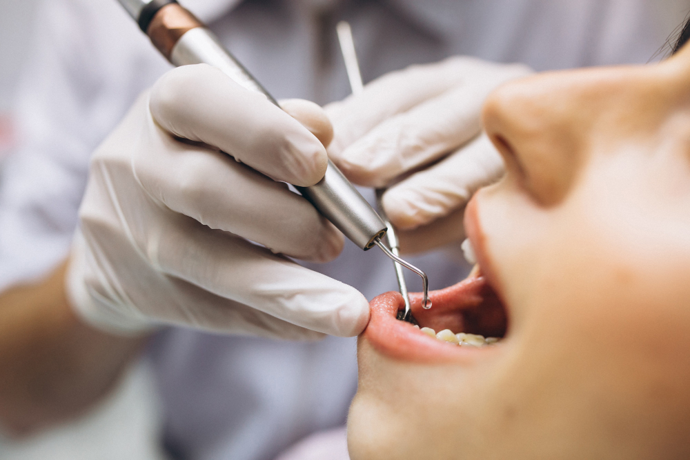 Como substituir os dentes ruins no dentista? Quais opções? 5 dentista